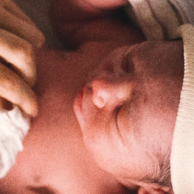 Come prendersi cura della pelle del bambino